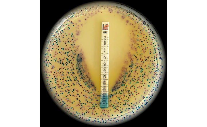 Liofilchem抗菌药物敏感性试验AST