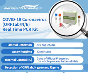 实时QPCR SARS-COV-2 Coronavirus Covid-19测试
