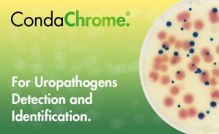 尿路致病菌检测和鉴定用CondaChrome