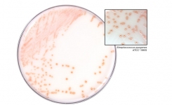 在HardyCHROM显色琼脂上的有色链球菌A菌落