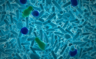 2小时内检测出脂杆菌，但没有PCR
