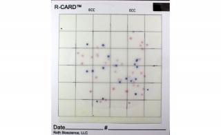 视频解释了R-CARD交易如何在单一测试中检测和枚举目标生物
