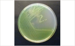 新型热科学培养基增强了em铜绿假单胞菌em的鉴定