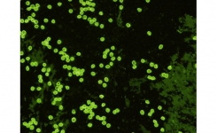 新的微小隐孢子虫单克隆抗体