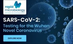 新型冠状病毒SARS-CoV-2检测试剂盒