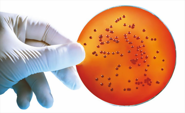 Burkholderia cepacia选择性agar